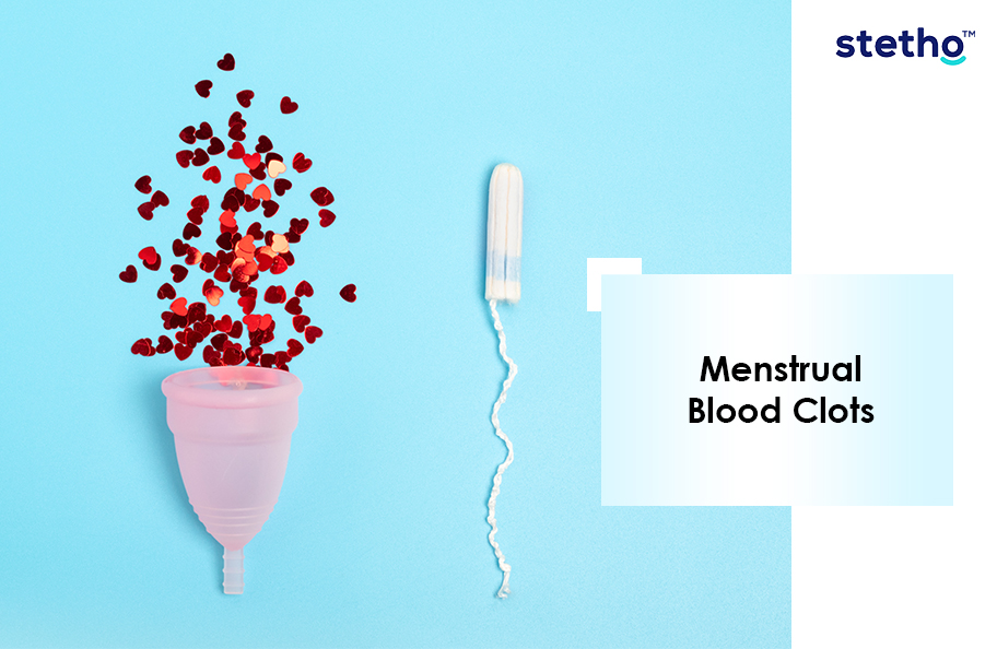 Menstrual Blood Clots